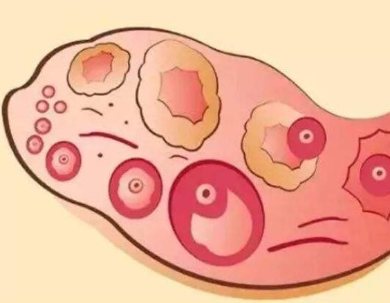 B超能看到卵泡萎缩