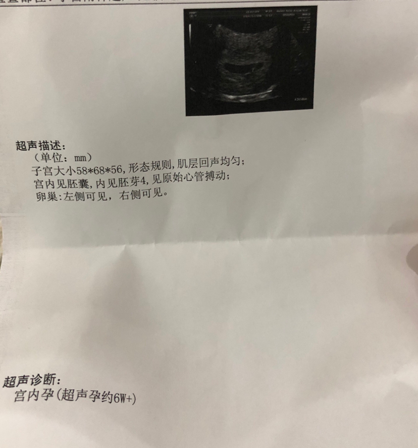 试管婴儿相关图片