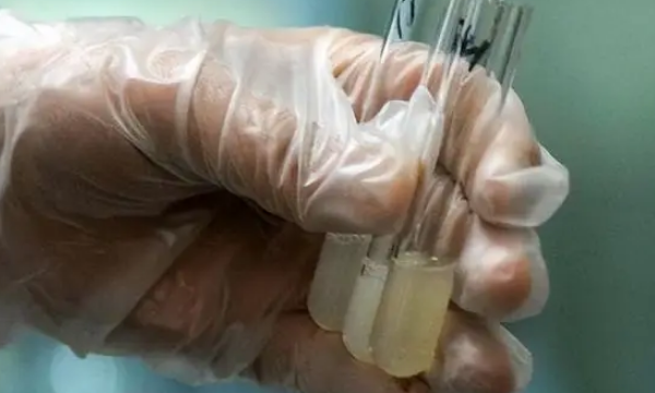 取精前的禁欲标准时间