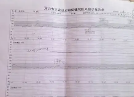 胎心率173次正常吗.png