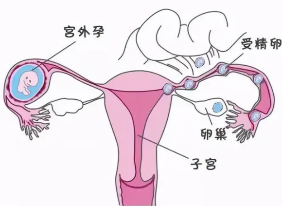 1095a3a068fd5fc7631090acd8feec2b8ddf2.png