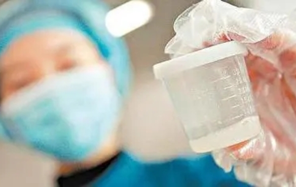自己进行借精子人工受孕需要在排卵期的时候取精