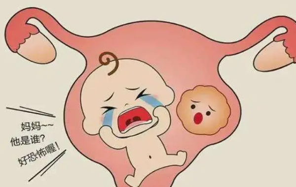 单卵双胎减胎的危险性