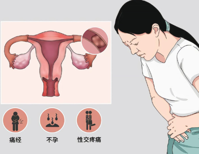 输卵管堵塞有多种治疗方案