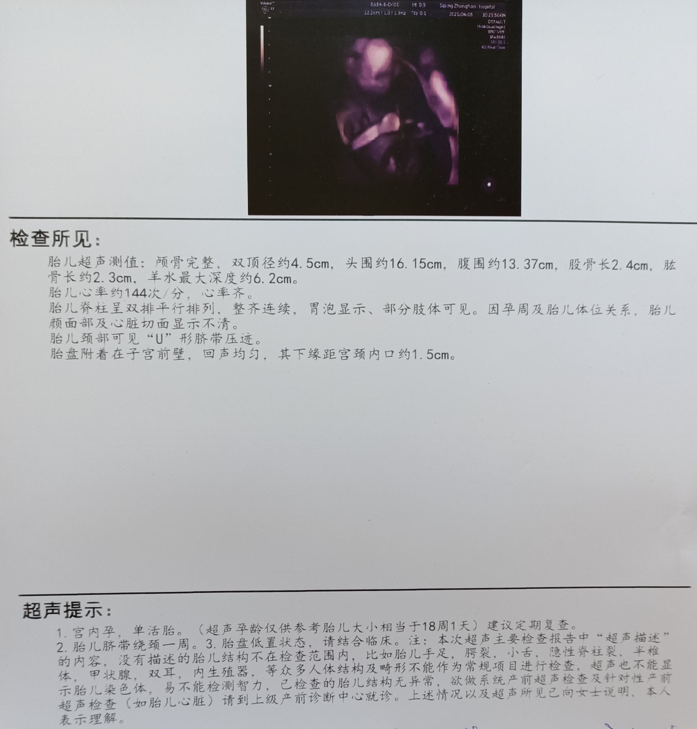 f96ab678-c3b8-44f7-ba61-475a05062c91