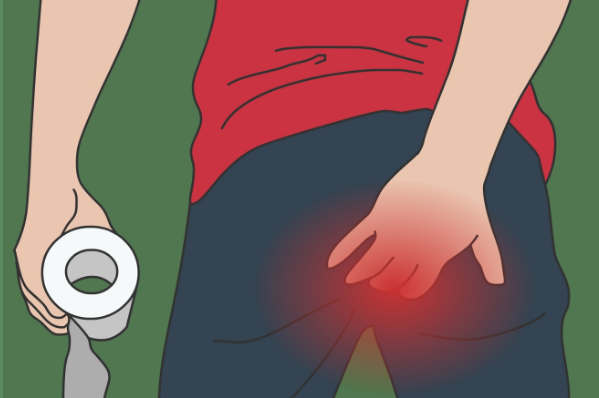 痔疮导致肛门坠痛