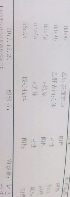 XW5U6PU~~W)F2}5[R08CIFK.png