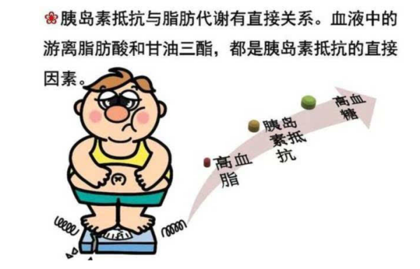 胰岛素抵抗