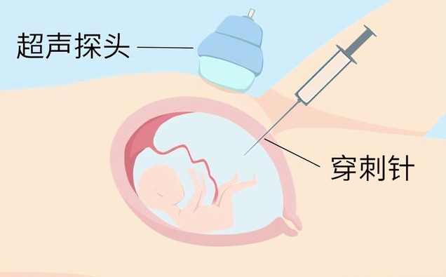 38岁试管怀孕不一定做羊穿
