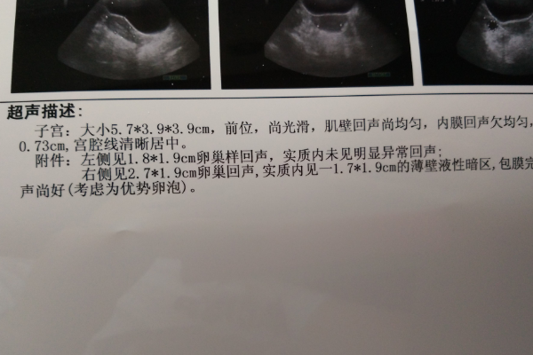药物敏感性低则内膜薄