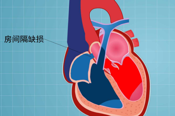 病情轻微不影响成功率