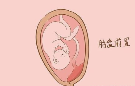 怀孕前壁和后壁看男女准不准，看宝妈聊经验！