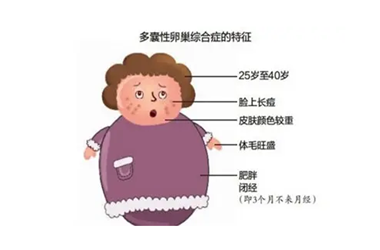 多囊为什么都生女孩