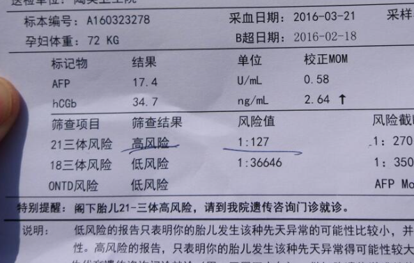 唐筛是孕期重要检查