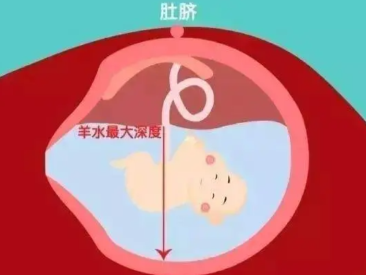 B超检查报告单详解：1分钟认识什么是羊水指数