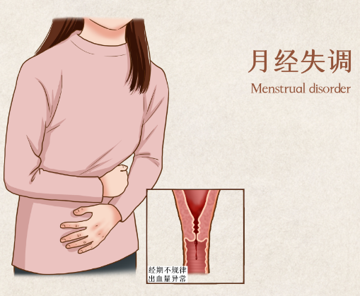 甲状腺高会引起月经失调