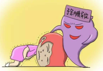 子宫内膜异位症手术次数