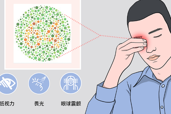 轻微色弱可做三代试管
