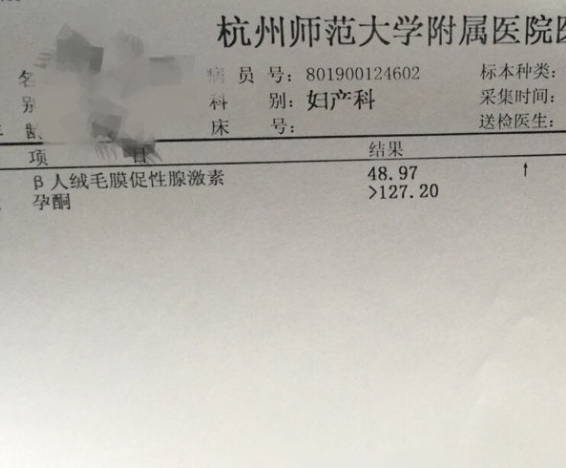 孕初期HCG无法决定胎儿发育