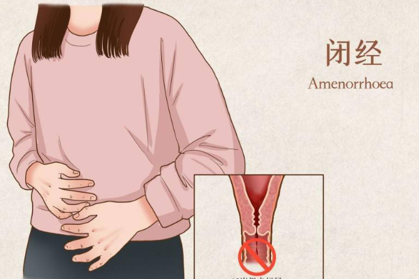 严重闭经可做供卵试管