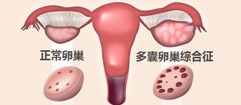 试管婴儿图片