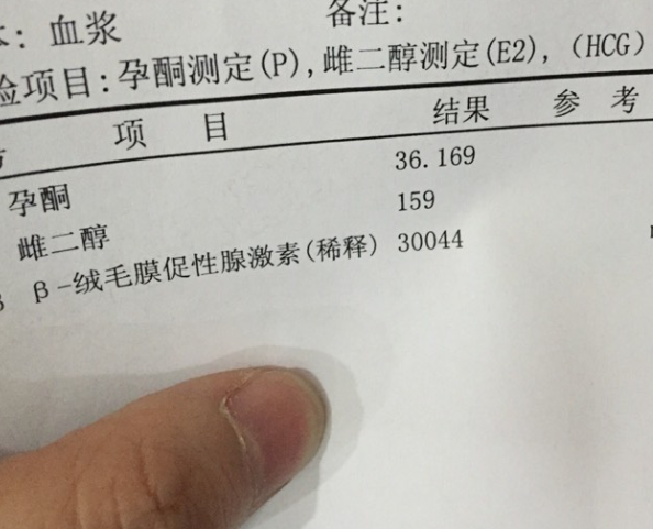 雌二醇水平影响移植着床率