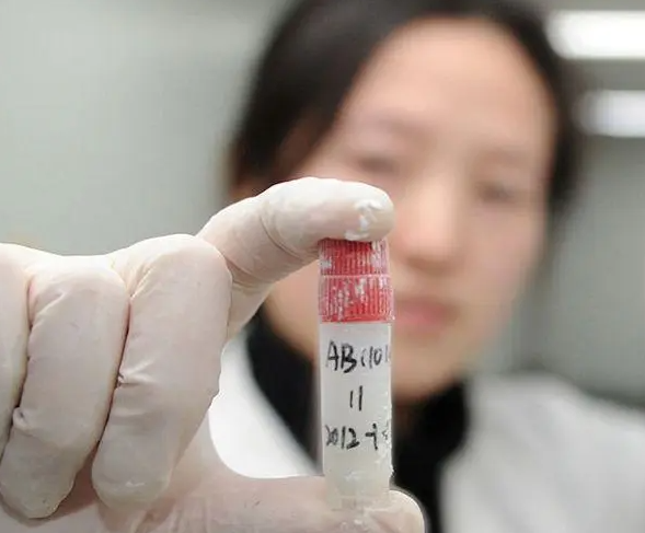 精子检查3-6个月做一次