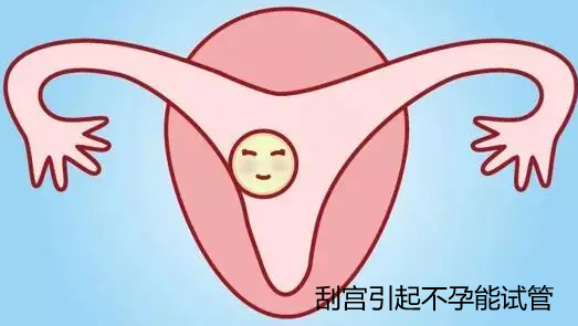 刮宫引起不孕能试管吗.png