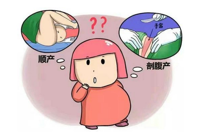 试管生产时不一定剖腹产