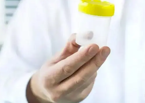 正常的精子状态
