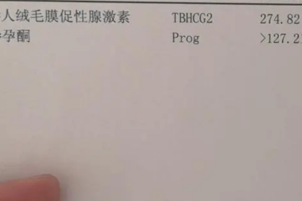 移植后等14天检查HCG浓度