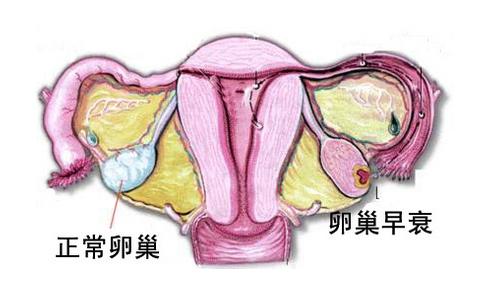 卵巢早衰.jpg