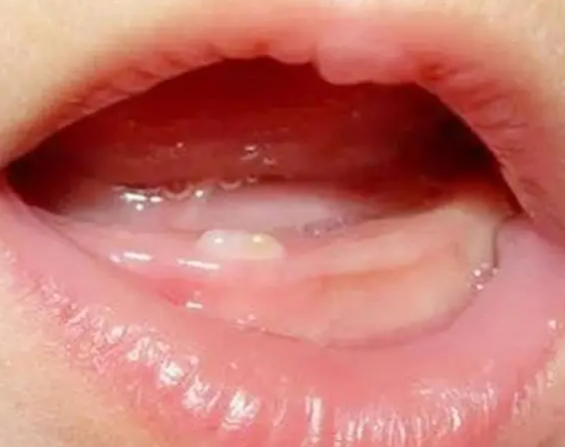 单出牙和发育有关