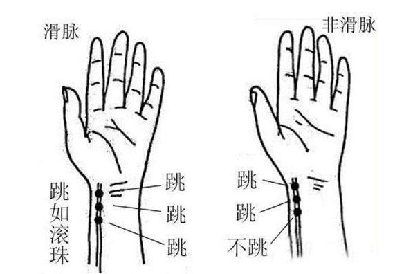 滑脉在拇指一侧方向