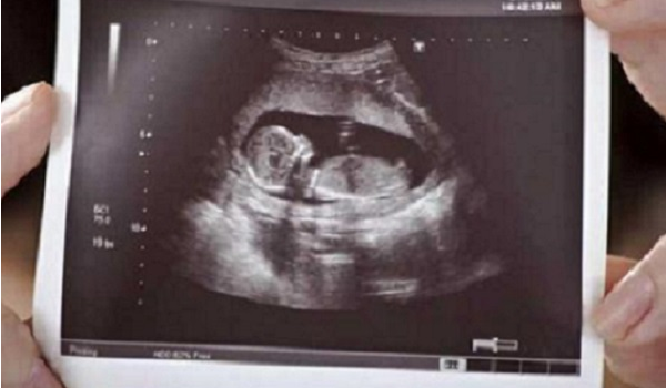 头大腿短是男宝概率不比女宝多
