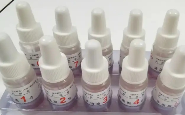 3细胞抗筛阴性可以试管