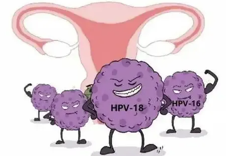 hpv阳性怎么治疗1.png