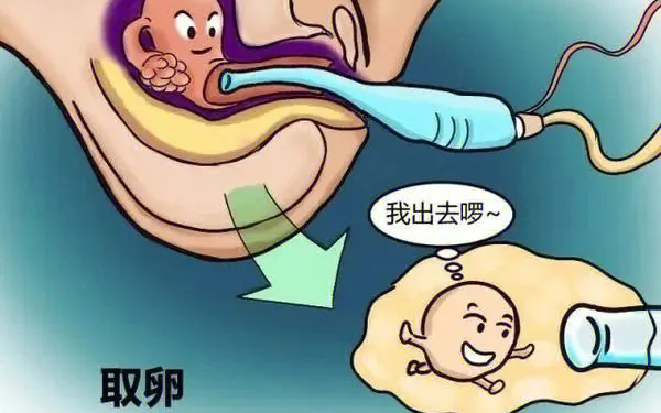 高龄试管促排一个是否取卵