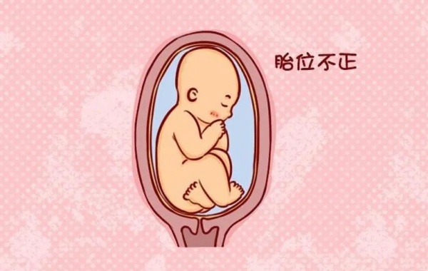 将手放在小腹底部或者放在腹部左右两侧等手法可以自测