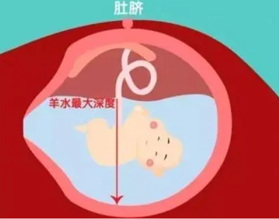 羊水深度异常会影响胎儿发育