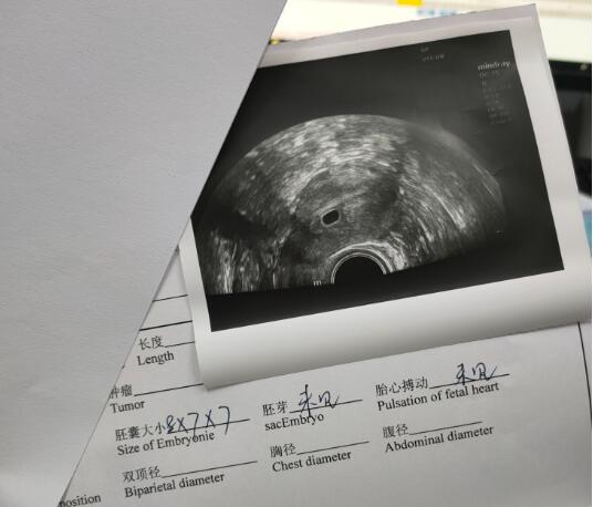 一超后肚子疼要注意观察