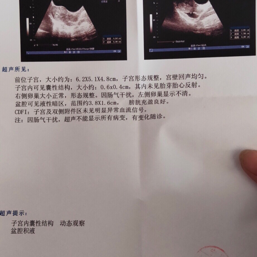 试管婴儿图片