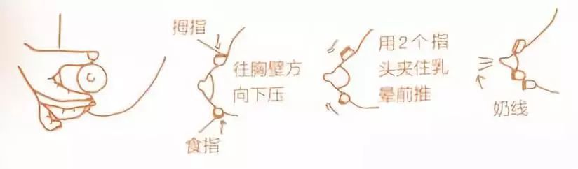 按摩可以解决堵奶的情况