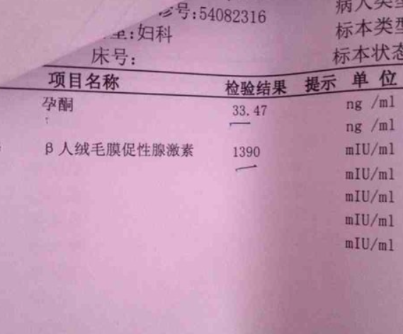 HCG值无法确定双胎妊娠