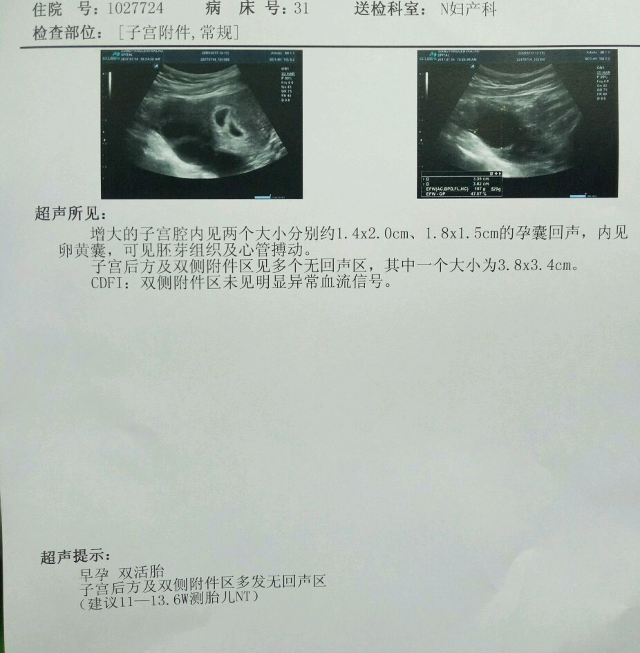 试管4.jpg