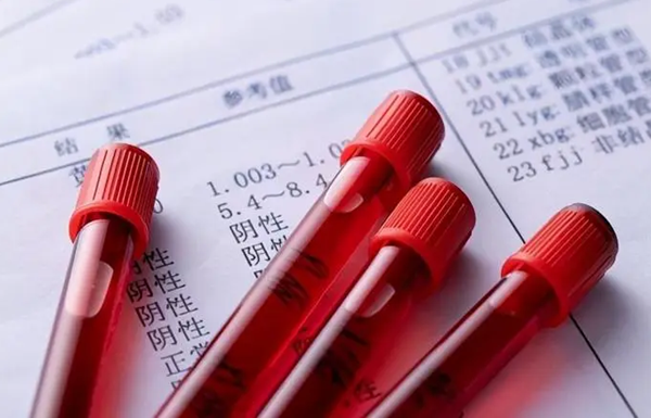 AMH和FSH对于卵泡发育谁更重要
