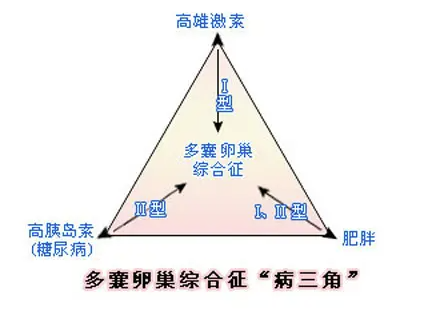 多囊性卵巢症候群.png