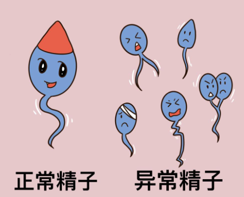 男性的精子畸形率高做试管婴儿会导致形成的胚胎质量差吗？