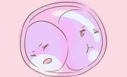 试管三胎减胎