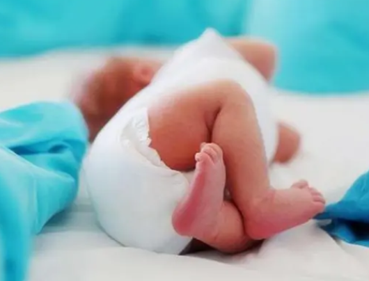 母乳喂养一天排10次左右